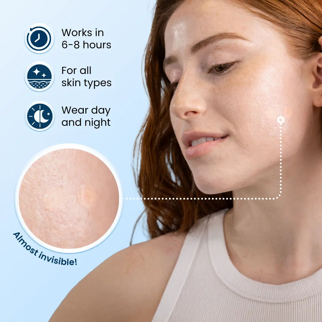 Clean Skin Club Derma Dot Invisible Pimple Patches 60 Vegan Hydrocolloid for Zits Blackhead Blemish Absorbing Face Sticker Skincare Treatment Non Toxic Ingredients Acne Blend Gentle Peel